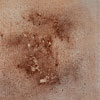 Fresco 2